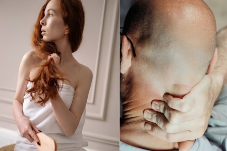 Cómo detener la caída del cabello: Cómo cuidar el cuero cabelludo